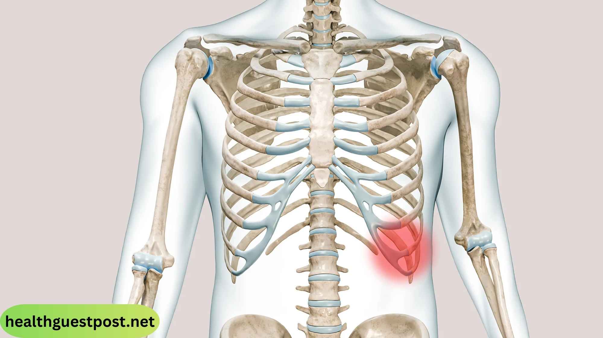 Slipping Rib Syndrome: Symptoms, Causes, and Treatment