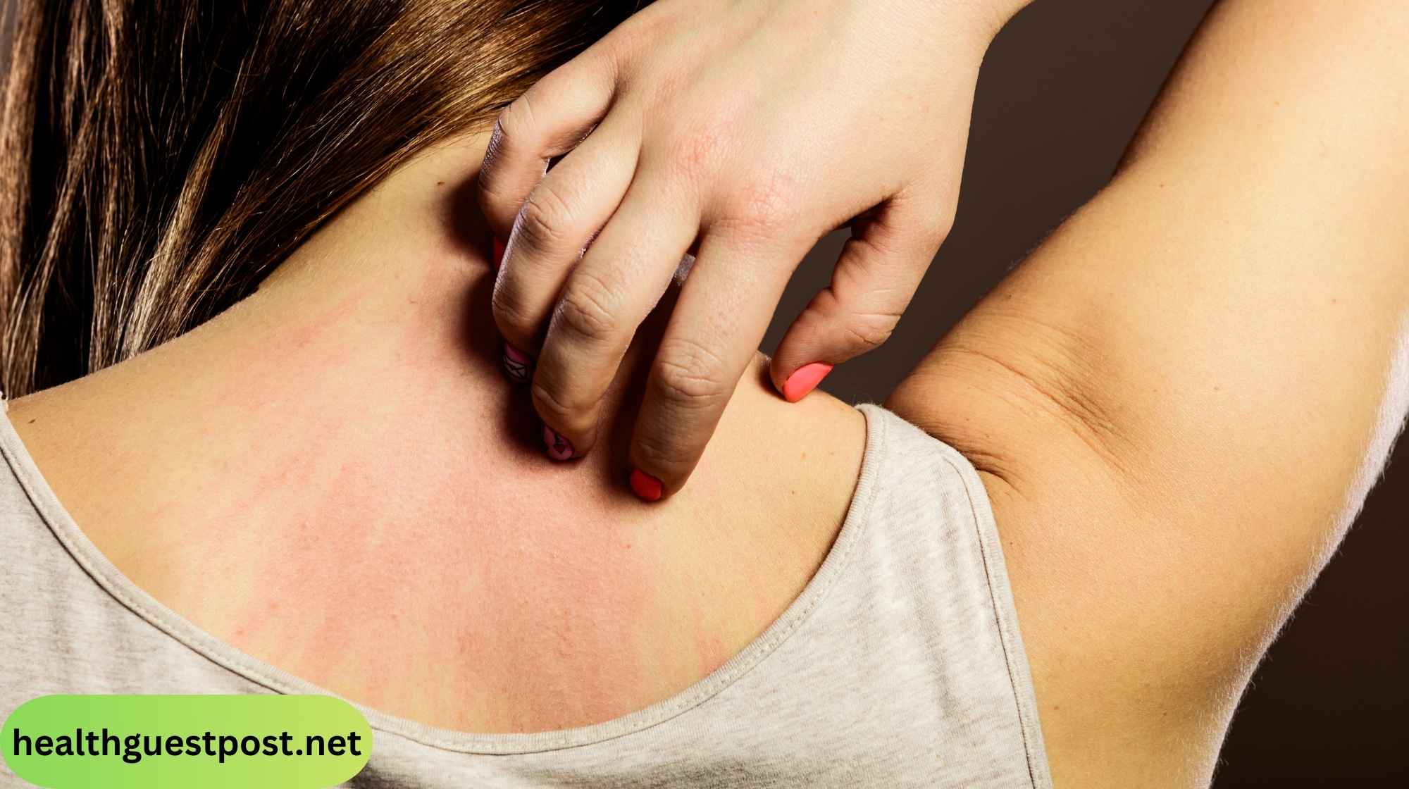  What Causes Sudden Skin Itching: Triggers & Treatment Options